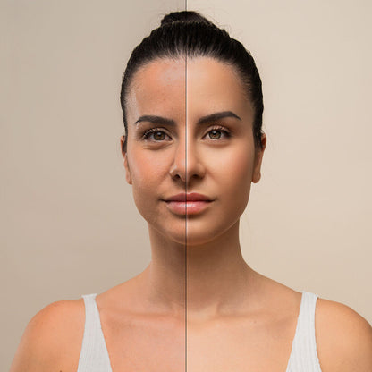 Massageador Facial Elétrico Reafirmante com LED, EMS e Calor