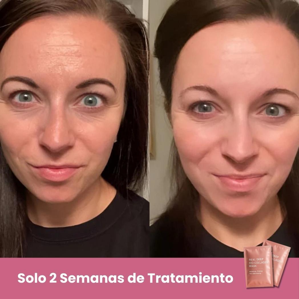 BIOMASK™ - Máscara Rejuvenescedora de Bio-Colagénio