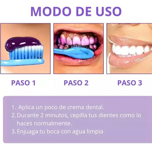 Smilekit V34 Teeth Whitening