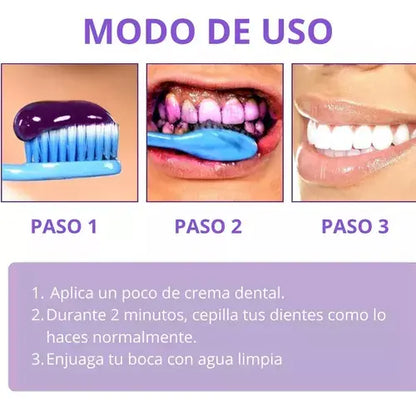 Smilekit V34 Teeth Whitening